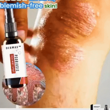 Dermax Tratamiento Vegetal para Psoriasis