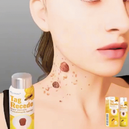 BeeClear Spray 20 ml – Eliminador de Verrugas y Manchas
