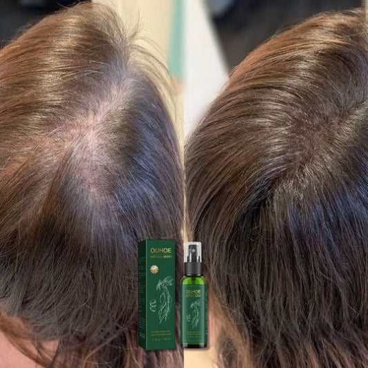 Suero Capilar de Ginseng OUHOE Natural Herbs (100ml) | Revitaliza el cuero cabelludo y el crecimiento del cabello