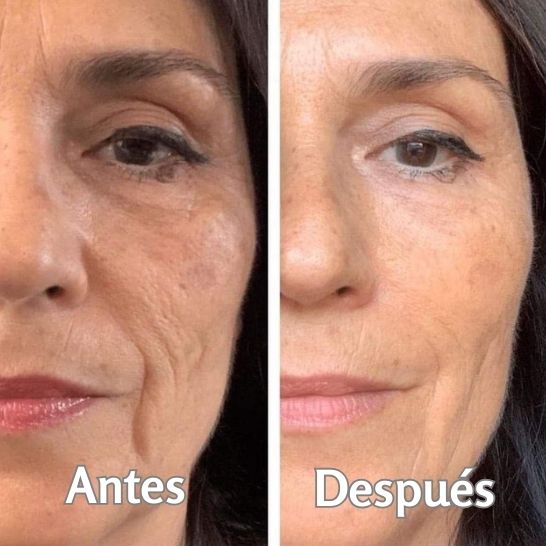 SERUM ANTIARRUGAS