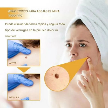 BeeClear Spray 20 ml – Eliminador de Verrugas y Manchas