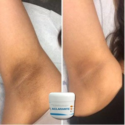 2 Crema Aclarante Despigmentante – Reduce Manchas, Melasma y Pecas –60 g