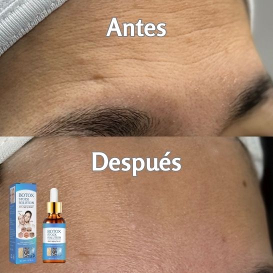 SERUM ANTIARRUGAS