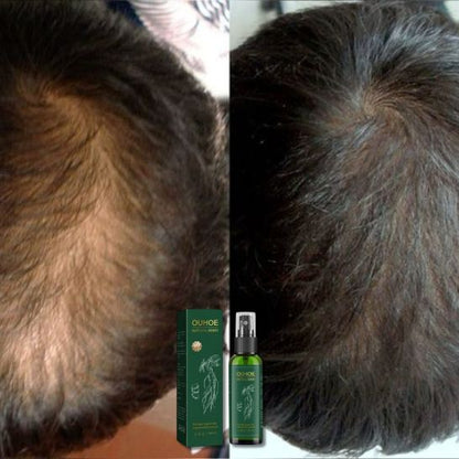 Suero Capilar de Ginseng OUHOE Natural Herbs (100ml) | Revitaliza el cuero cabelludo y el crecimiento del cabello