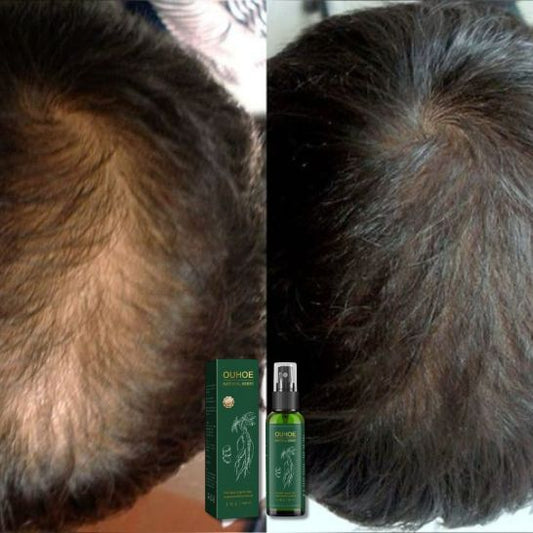 Suero Capilar de Ginseng OUHOE Natural Herbs (100ml) | Revitaliza el cuero cabelludo y el crecimiento del cabello