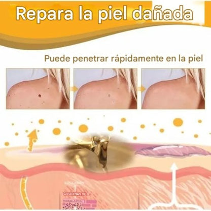 BeeClear Spray 20 ml – Eliminador de Verrugas y Manchas