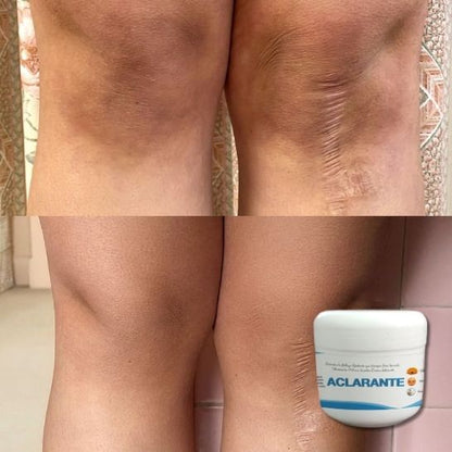 2 Crema Aclarante Despigmentante – Reduce Manchas, Melasma y Pecas –60 g