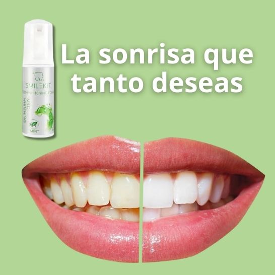 SmileKit – Espuma Dental Suave que Blanquea y Refresca