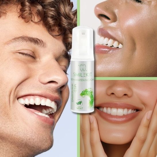 SmileKit – Espuma Dental Suave que Blanquea y Refresca