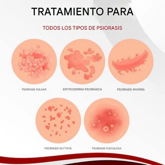Dermax Tratamiento Vegetal para Psoriasis