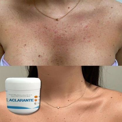 2 Crema Aclarante Despigmentante – Reduce Manchas, Melasma y Pecas –60 g