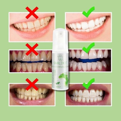 SmileKit – Espuma Dental Suave que Blanquea y Refresca