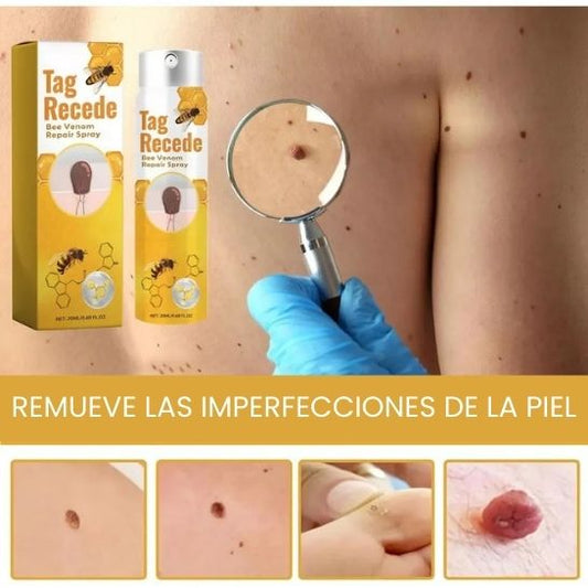 BeeClear Spray 20 ml – Eliminador de Verrugas y Manchas