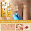 BeeClear Spray 20 ml – Eliminador de Verrugas y Manchas