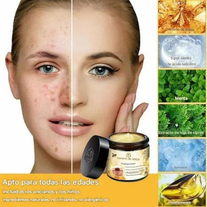 Crema Facial con Veneno de Abeja 60ml (2x1)– Antiedad, Antiacné y Hidratación Natural