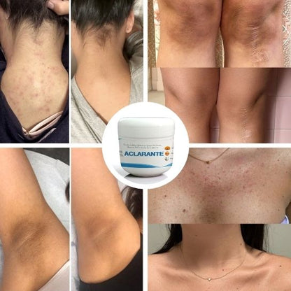 2 Crema Aclarante Despigmentante – Reduce Manchas, Melasma y Pecas –60 g