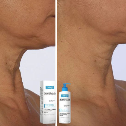 Hoygi Skin Radiance – Crema Reafirmante Hidratante Multifuncional Rostro y Cuerpo