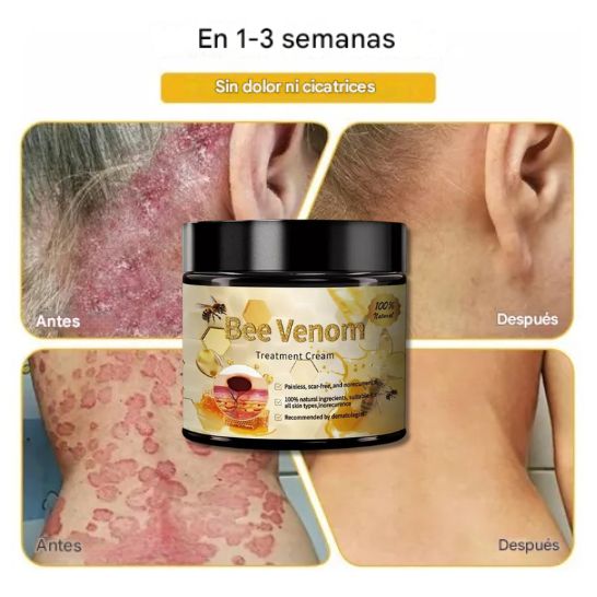 Crema Facial con Veneno de Abeja 60ml (2x1)– Antiedad, Antiacné y Hidratación Natural