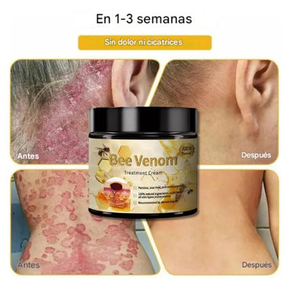 Crema Facial con Veneno de Abeja 60ml (2x1)– Antiedad, Antiacné y Hidratación Natural