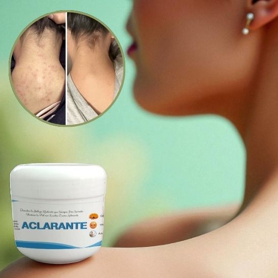2 Crema Aclarante Despigmentante – Reduce Manchas, Melasma y Pecas –60 g