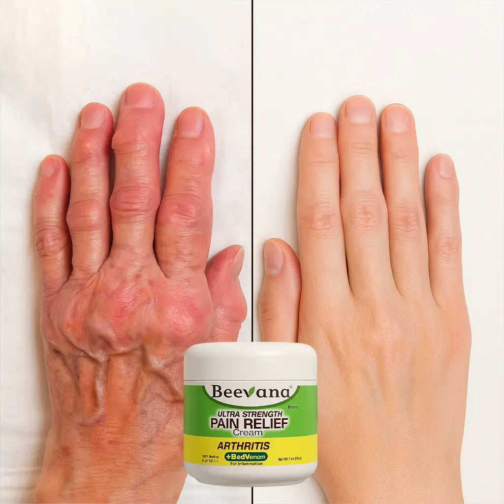 🐝 Beevana – Crema con Veneno de Abeja. Recupera tu movilidad. Recupera tu vida
