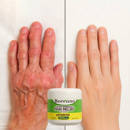 🐝 Beevana – Crema con Veneno de Abeja. Recupera tu movilidad. Recupera tu vida