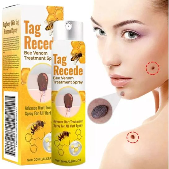 BeeClear Spray 20 ml – Eliminador de Verrugas y Manchas