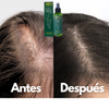 Suero Capilar de Ginseng OUHOE Natural Herbs (100ml) | Recupera tu cabello, detén la caída y realza tu feminidad ✨