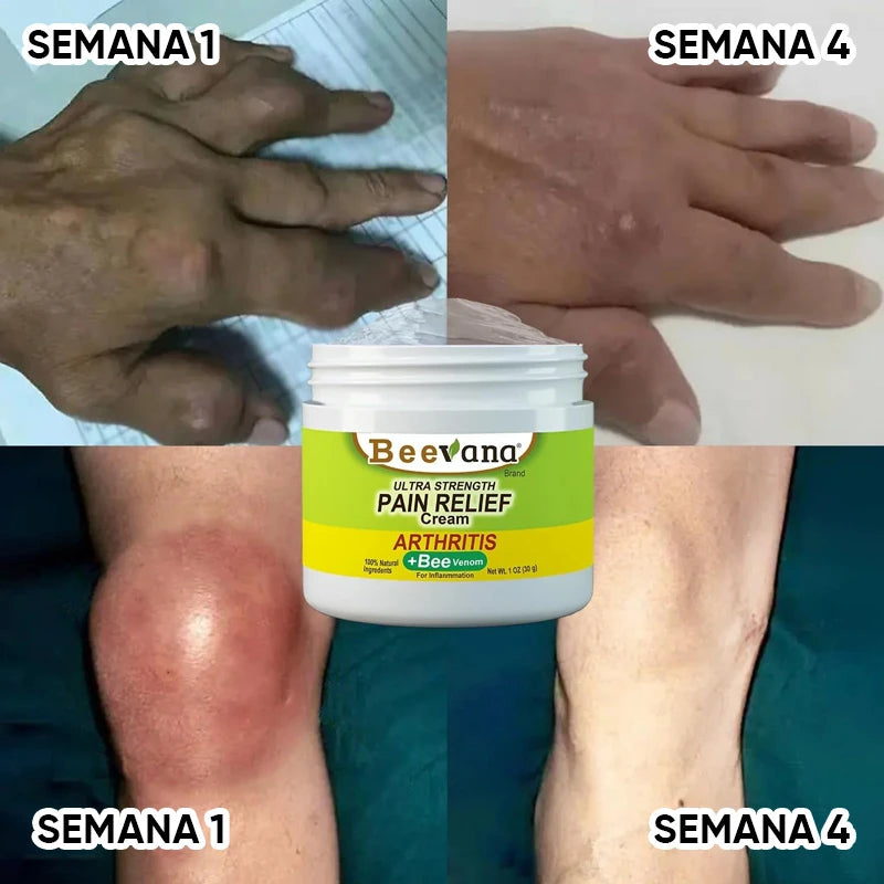 🐝 Beevana – Crema con Veneno de Abeja. Recupera tu movilidad. Recupera tu vida